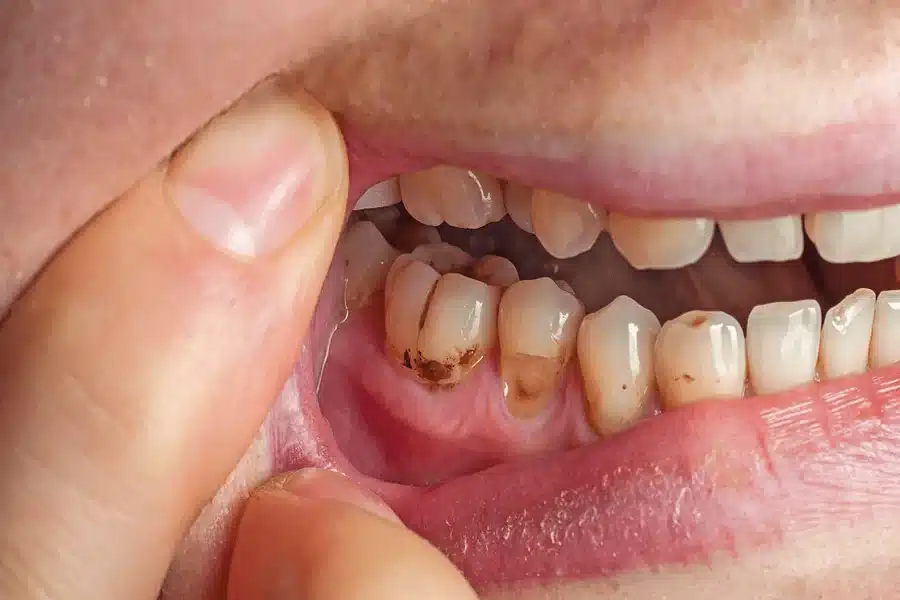 Dentistry Detects