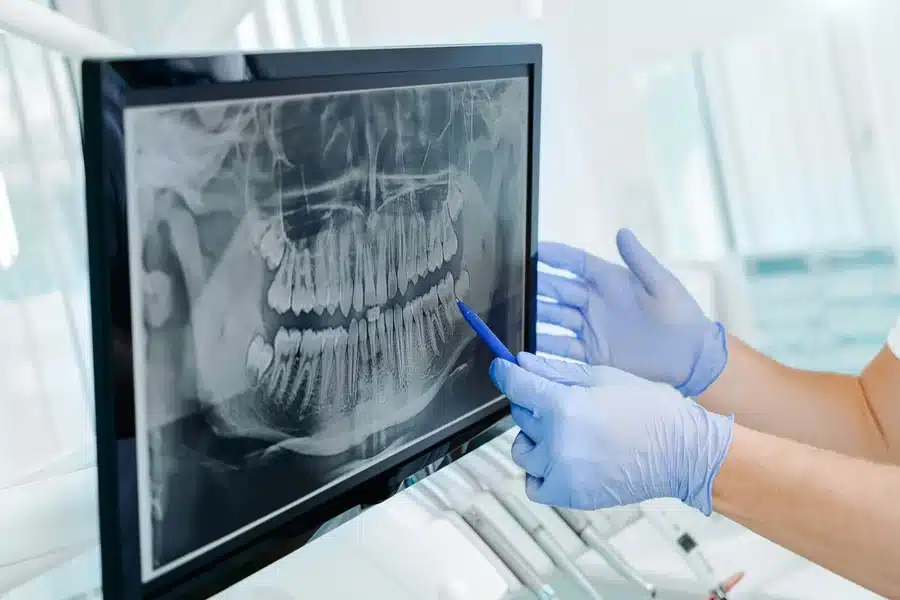 X Rays